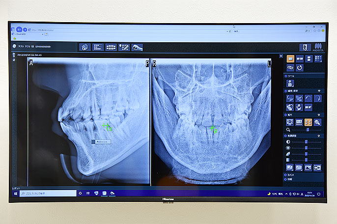 歯科用C画像